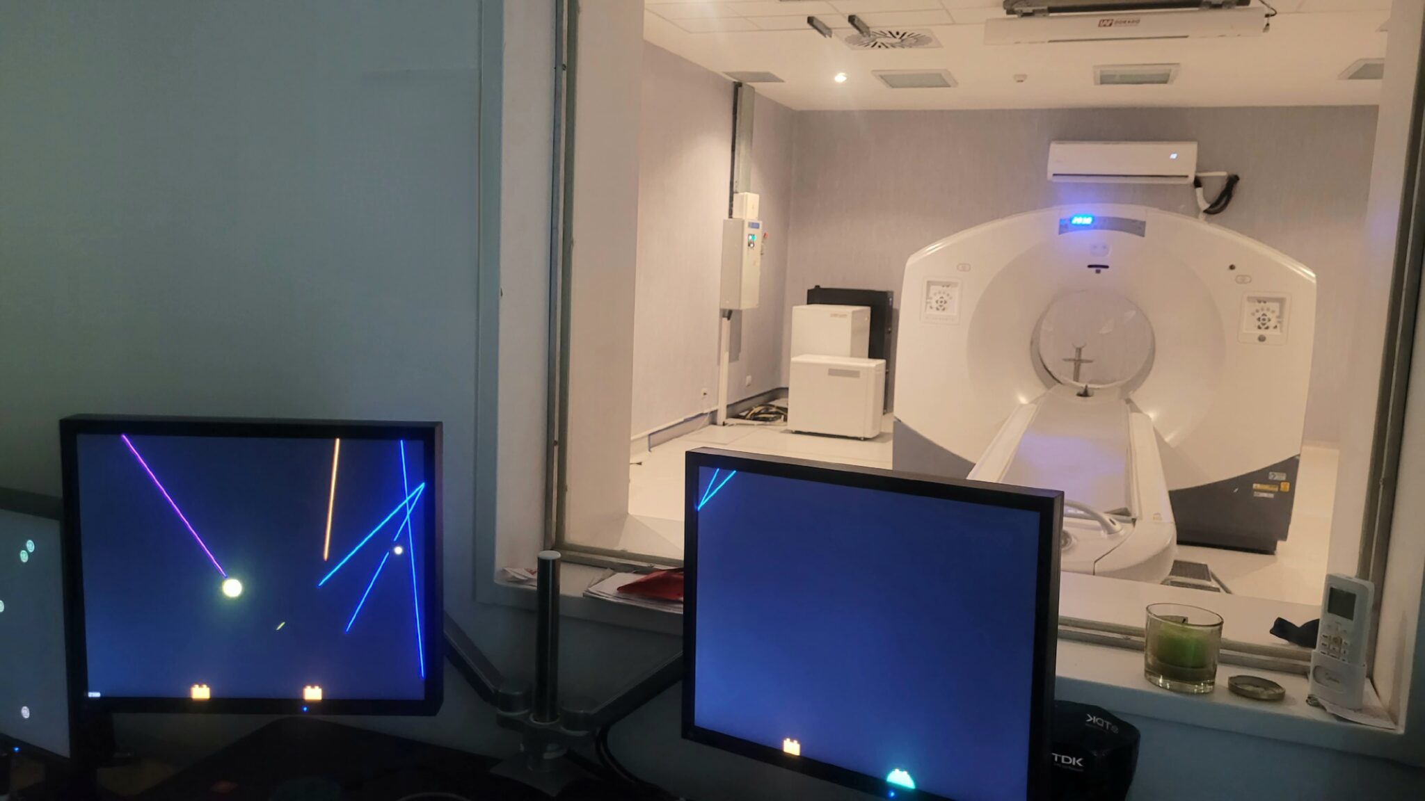 PET-CT -04